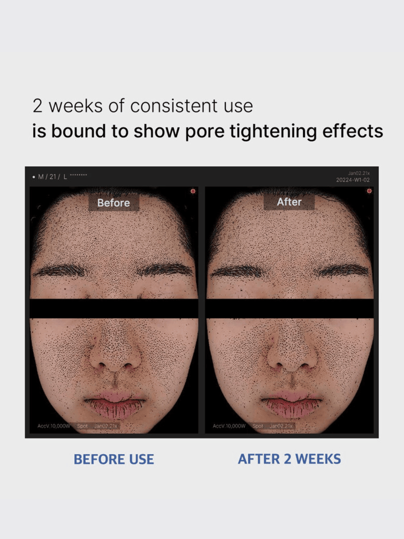 Zero Pore Pad 2.0